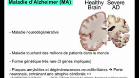 PACES_UEsp MEDECINE-C15 Neurodégénérescence - Les maladies prion-like