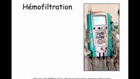 PACES_UE3B-B9 Filtration - Hémofiltration (4)_D. VANDROUX